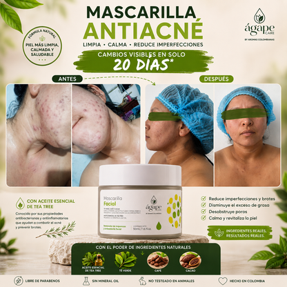 Mascarilla antiacné y seborreguladora